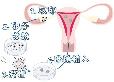 嘉会医疗